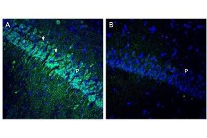 Expression of OCTN1 in rat hippocampus. (SLC22A4 抗体  (Intracellular))