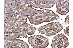 IHC-P Image alpha Actinin 4 antibody [C2C3], C-term detects alpha Actinin 4 protein on mouse intestine by immunohistochemical analysis. (alpha Actinin 4 抗体  (C-Term))