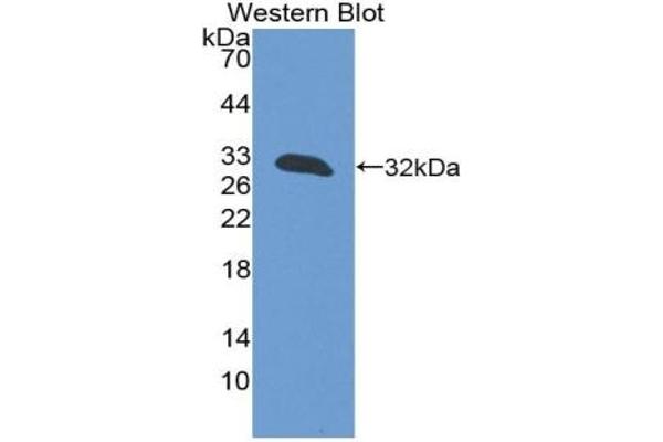 T-Bet Antikörper  (AA 241-493)