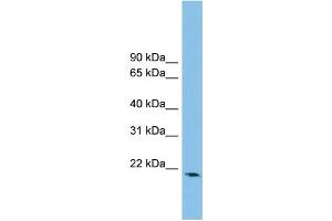 WB Suggested Anti-RHOB Antibody Titration: 0. (RHOB 抗体  (Middle Region))
