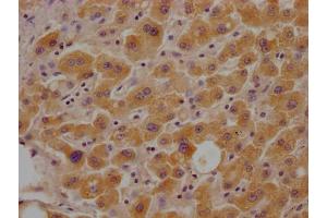 IHC image of ABIN7153713 diluted at 1:100 and staining in paraffin-embedded human liver tissue performed on a Leica BondTM system. (Glucose-6-Phosphate Dehydrogenase 抗体  (AA 422-712))
