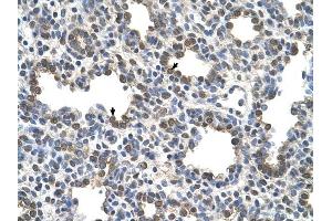 BCHE antibody was used for immunohistochemistry at a concentration of 4-8 ug/ml to stain Alveolar cells (arrows) in Human Lung. (Butyrylcholinesterase 抗体  (N-Term))