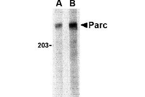Western blot analysis of PARC in Daudi lysate with PARC antibody at (A) 1 and (B) 2 µg/mL. (CUL9 抗体  (C-Term))