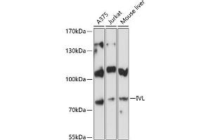Western blot analysis of extracts of various cell lines, using IVL antibody (ABIN6128143, ABIN6142620, ABIN6142621 and ABIN6224048) at 1:3000 dilution. (Involucrin 抗体  (AA 416-585))