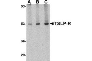 Western blot analysis of TSLP Receptor in human liver tissue lysate with this product at (A) 0. (CRLF2 抗体  (Center))