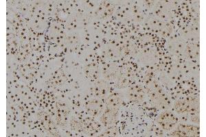 ABIN6279425 at 1/100 staining Rat kidney tissue by IHC-P.