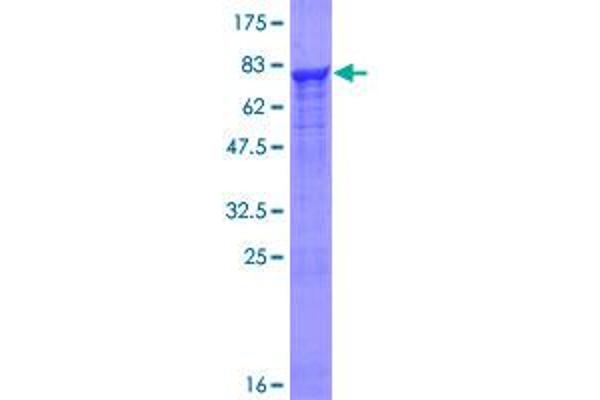 PRP19 Protein (AA 1-504) (GST tag)