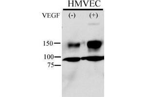 Anti-Phospho-KDR/FLK1- Pab (ABIN389564 and ABIN2839596) is used in Western blot to detect Phospho-KDR/FLK1- in HMVEC cell line lysate. (VEGFR2/CD309 抗体  (pTyr996))