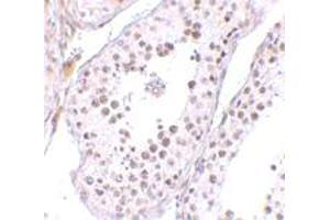 Immunohistochemical staining of human testis tissue with 10 ug/mL MED4 polyclonal antibody . (MED4 抗体  (C-Term))