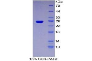 SDS-PAGE analysis of Human Sprouty Homolog 3 Protein. (SPRY3 蛋白)