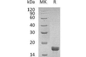 Western Blotting (WB) image for Interleukin 2 (IL2) (Active) protein (ABIN7320817) (IL-2 蛋白)