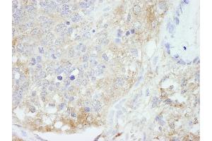 Immunohistochemistry (IHC) image for anti-Host Cell Factor C1 Regulator 1 (XPO1 Dependent) (HCFC1R1) (AA 1-50) antibody (ABIN7448976)