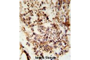 Formalin-fixed and paraffin-embedded human testis tissue reacted with ACR Antibody (C-term), which was peroxidase-conjugated to the secondary antibody, followed by DAB staining. (Acrosin 抗体  (C-Term))