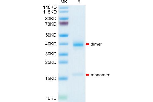 TTR Protein (AA 21-147) (His tag)