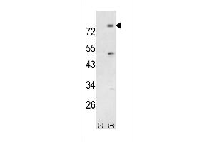 Western blot analysis of PIK3R5 (arrow) using rabbit polyclonal PIK3R5 Antibody (Center) (ABIN392579 and ABIN2842114). (PIK3R5 抗体  (AA 392-421))