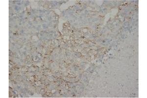 Immunohistochemistry (IHC) image for anti-alpha-Fetoprotein (AFP) antibody (ABIN1105327) (alpha Fetoprotein 抗体)