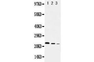 Anti-rat IL10 antibody, Western blotting Lane 1: Recombinant Rat IL10 Protein 10ng Lane 2: Recombinant Rat IL10 Protein 5ng Lane 3: Recombinant Rat IL10 Protein 2 (IL-10 抗体  (AA 19-178))