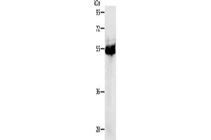 Western Blotting (WB) image for anti-Protein Kinase, CAMP-Dependent, Regulatory, Type I, beta (PRKAR1B) antibody (ABIN2426823) (PRKAR1B 抗体)
