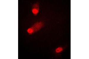 Immunofluorescent analysis of MKK4 (pS80) staining in HEK293T cells. (MAP2K4 抗体  (pSer80))