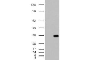 Image no. 2 for anti-Hydroxyacyl-CoA Dehydrogenase (HADH) (Internal Region) antibody (ABIN374901) (HADH 抗体  (Internal Region))