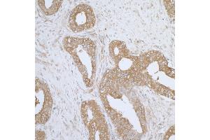 anti-Aminoacyl tRNA Synthetase Complex-Interacting Multifunctional Protein 1 (AIMP1) (AA 262-312) antibody