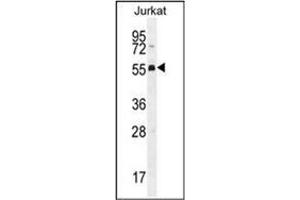 Western blot analysis of PODNL1 Antibody (Center) Cat. (PODNL1 抗体  (Middle Region))