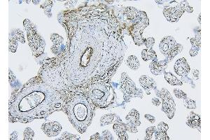 IHC analysis of Filamin B/FLNB using anti-Filamin B/FLNB antibody (ABIN7601607). (FLNB 抗体  (AA 397-701))