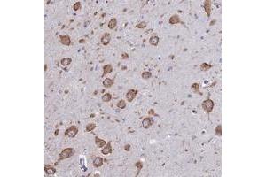 Immunohistochemical staining of human hippocampus with WDR35 polyclonal antibody  shows strong cytoplasmic positivity in neurons. (WDR35 抗体)
