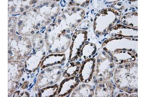 Immunohistochemical staining of paraffin-embedded Kidney tissue using anti-ATP5B mouse monoclonal antibody. (ATP5B 抗体)
