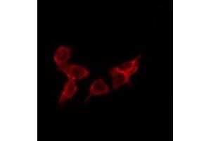 Immunofluorescence (fixed cells) (IF/ICC) image for anti-DnaJ (Hsp40) Homolog, Subfamily C, Member 5 (DNAJC5) (Internal Region) antibody (ABIN6257124)