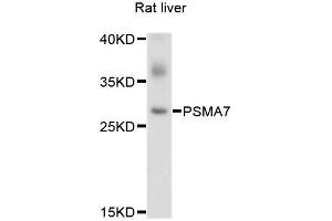 Western blot analysis of extracts of rat liver, using PSMA7 antibody. (PSMA7 抗体  (AA 1-248))