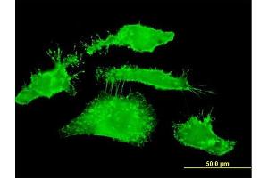Immunofluorescence of monoclonal antibody to RDX on HeLa cell. (Radixin 抗体  (AA 1-583))