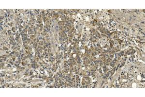 IHC analysis of RGS6 using anti-RGS6 antibody (ABIN7602326).