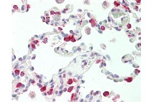 Anti-SFTPC / Surfactant Protein C antibody IHC staining of human lung. (Surfactant Protein C 抗体  (AA 1-30))