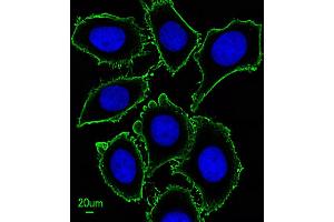 Immunofluorescent analysis of  cells, using KIT Antibody (ABIN1882197 and ABIN2843885). (KIT 抗体)