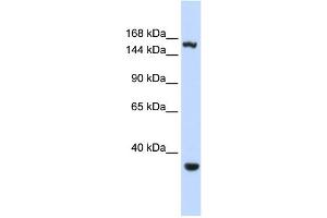 WB Suggested Anti-EIF4G3 Antibody Titration:  0. (EIF4G3 抗体  (Middle Region))