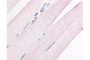 Immunohistochemical (Formalin/PFA-fixed paraffin-embedded sections) staining in human skeletal muscle with PDE7A polyclonal antibody . (PDE7A 抗体)