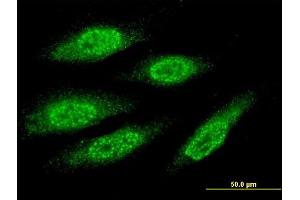 Immunofluorescence of monoclonal antibody to MAGEA8 on HeLa cell. (MAGEA8 抗体  (AA 1-318))
