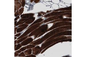 Immunohistochemical staining (Formalin-fixed paraffin-embedded sections) of human skeletal muscle with MYH6 monoclonal antibody, clone CL2148  shows strong cytoplasmic immunoreactivity in striated muscle fibers. (MYH6 抗体)