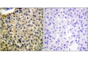 Immunohistochemistry (IHC) image for anti-Mast/stem Cell Growth Factor Receptor (KIT) (AA 671-720), (pTyr703) antibody (ABIN1531334)