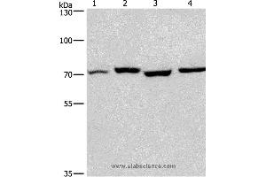 Western blot analysis of Human fetal liver and mouse stomach tissue, hela and hepG2 cell, using ARNTL Polyclonal Antibody at dilution of 1:450 (ARNTL 抗体)