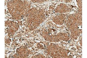 Immunohistochemistry analysis using Rabbit Anti-ROR1 Polyclonal Antibody (ABIN5667798).