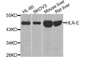 Western blot analysis of extracts of various cells, using HLA-E antibody. (HLA-E 抗体)