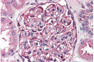 Human Kidney (formalin-fixed, paraffin-embedded) stained with SGK2 antibody ABIN410773 followed by biotinylated goat anti-rabbit IgG secondary antibody ABIN481713, alkaline phosphatase-streptavidin and chromogen. (SGK2 抗体  (Kinase Domain))