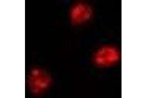 Immunofluorescent analysis of FIR staining in Hela cells. (FARP2 抗体)
