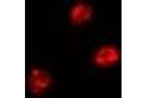 Immunofluorescent analysis of FIR staining in Hela cells.