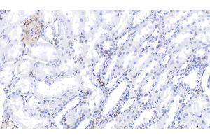 Detection of GAL1 in Bovine Kidney Tissue using Polyclonal Antibody to Galectin 1 (GAL1) (LGALS1/Galectin 1 抗体  (AA 1-135))