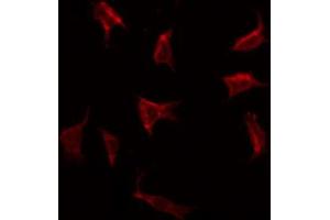 ABIN6269293 staining HeLa by IF/ICC. (RPS6 抗体  (C-Term))