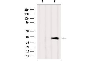 Western blot analysis of extracts from Mouse brain, using CAPZA1 Antibody.