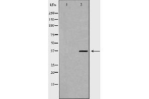 Western blot analysis of Hela whole cell lysates, using PSMD7 Antibody. (PSMD7 抗体  (C-Term))